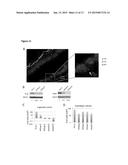 EMT-INDUCING TRANSCRIPTION FACTORS COOPERATE WITH SOX9 diagram and image