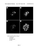 IN VITRO DIFFERENTIATION OF PLURIPOTENT STEM CELLS TO PANCREATIC ENDODERM     CELLS (PEC) AND ENDOCRINE CELLS diagram and image