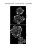 IN VITRO DIFFERENTIATION OF PLURIPOTENT STEM CELLS TO PANCREATIC ENDODERM     CELLS (PEC) AND ENDOCRINE CELLS diagram and image
