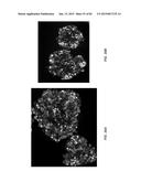 IN VITRO DIFFERENTIATION OF PLURIPOTENT STEM CELLS TO PANCREATIC ENDODERM     CELLS (PEC) AND ENDOCRINE CELLS diagram and image