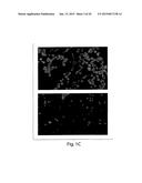 BACTERIAL MEDIATED THF ALPHA GENE SILENCING diagram and image