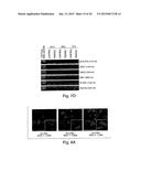 BACTERIAL MEDIATED THF ALPHA GENE SILENCING diagram and image