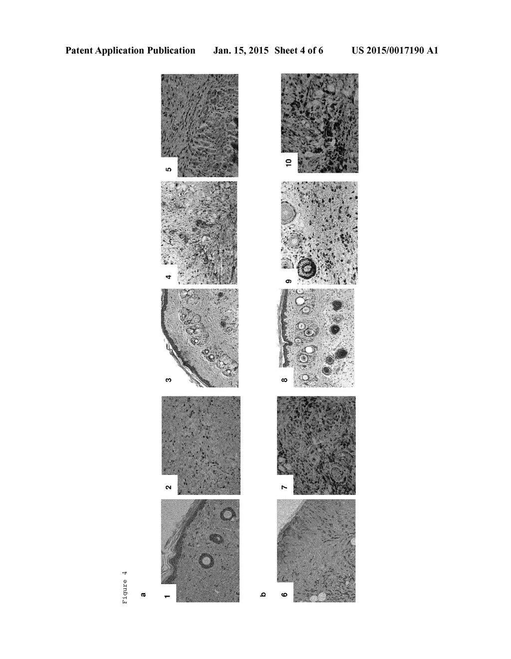 USE OF EPITOPES INDUCING SPECIFIC TOLERANCE FOR THE PREVENTION OF TISSUE     REJECTION - diagram, schematic, and image 05