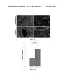 METHODS FOR TREATING CARDIAC CONDITIONS diagram and image