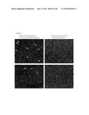 ENZYME DETECTION BY MICROFLUIDICS diagram and image