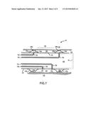 INFLATABLE MEMBER FOR AN ENDOSCOPE SHEATH diagram and image