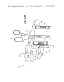 SURGICAL VISUALIZATION SYSTEMS diagram and image