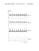 MULTIFACTORIAL TELEHEALTH CARE PREGNANCY AND BIRTH MONITORING diagram and image