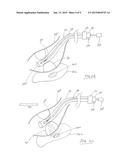 SYSTEMS AND METHODS FOR TREATING PANCREATIC CANCER diagram and image