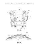 ORTHOPEDIC DEVICE diagram and image