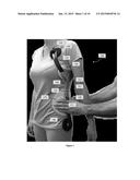 Scoliosis Brace diagram and image