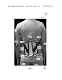 Scoliosis Brace diagram and image