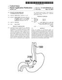 DEVICES AND METHODS FOR GASTROINTESTINAL BYPASS diagram and image