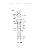 DEVICES AND METHODS FOR GASTROINTESTINAL BYPASS diagram and image