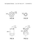 DEVICES AND METHODS FOR GASTROINTESTINAL BYPASS diagram and image