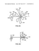 DEVICES AND METHODS FOR GASTROINTESTINAL BYPASS diagram and image