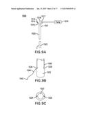 DEVICES AND METHODS FOR GASTROINTESTINAL BYPASS diagram and image