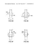 DEVICES AND METHODS FOR GASTROINTESTINAL BYPASS diagram and image