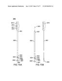 DEVICES AND METHODS FOR GASTROINTESTINAL BYPASS diagram and image