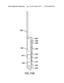 DEVICES AND METHODS FOR GASTROINTESTINAL BYPASS diagram and image