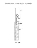 DEVICES AND METHODS FOR GASTROINTESTINAL BYPASS diagram and image