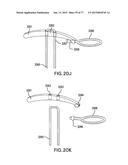 DEVICES AND METHODS FOR GASTROINTESTINAL BYPASS diagram and image