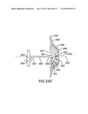 DEVICES AND METHODS FOR GASTROINTESTINAL BYPASS diagram and image