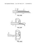 DEVICES AND METHODS FOR GASTROINTESTINAL BYPASS diagram and image