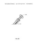 Infusion Pump Assembly diagram and image