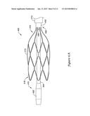 DEVICES AND METHODS FOR NERVE MODULATION diagram and image