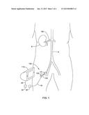 MEDICAL DEVICE WITH STRETCHABLE ELECTRODE ASSEMBLIES diagram and image