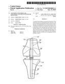 Anti-Septic Transarticular Intramedullary Rod System for the Human Knee diagram and image