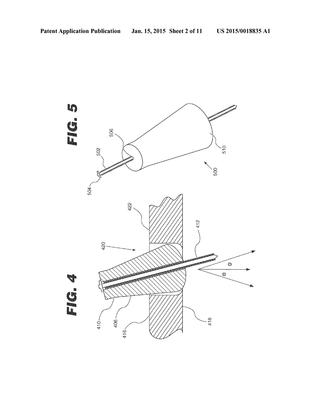 IMPLANT FIXATION MEMBER HOLDER - diagram, schematic, and image 03