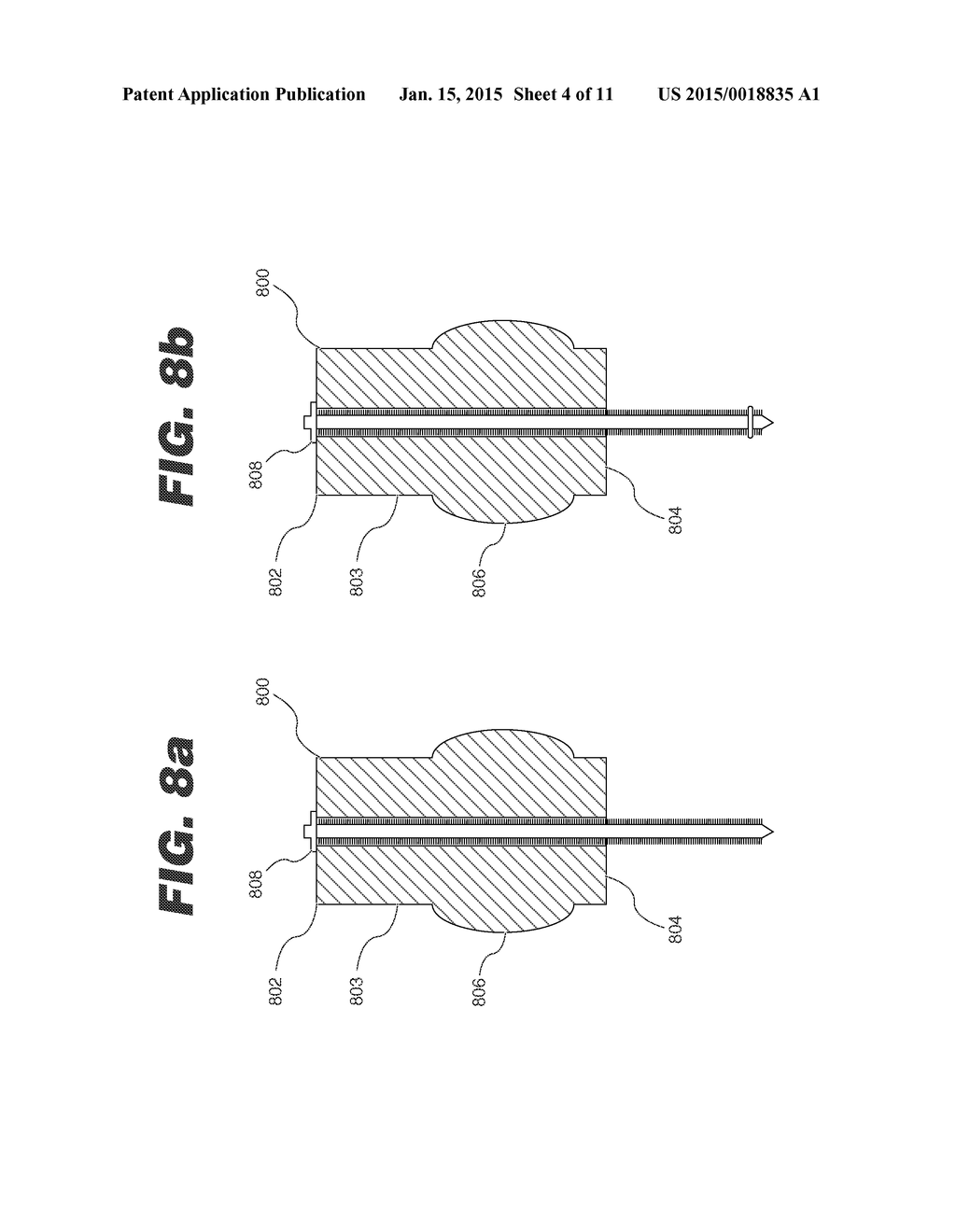 IMPLANT FIXATION MEMBER HOLDER - diagram, schematic, and image 05