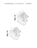 IMPLANT FIXATION MEMBER HOLDER diagram and image