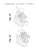 IMPLANT FIXATION MEMBER HOLDER diagram and image