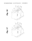 IMPLANT FIXATION MEMBER HOLDER diagram and image