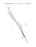 METHODS AND APPARATUS FOR TREATING SMALL VESSEL THROMBOEMBOLISMS diagram and image