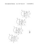 GLENOIDAL COMPONENT, SET OF SUCH COMPONENTS AND SHOULDER PROSTHESIS     INCORPORATING SUCH A GLENOIDAL COMPONENT diagram and image