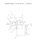 SYSTEM AND METHOD FOR TEETH CLEANING diagram and image