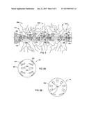 Multiple-Interval Wellbore Stimulation System and Method diagram and image