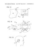 DIALYSIS SYSTEM HAVING NON-INVASIVE FLUID VELOCITY SENSING diagram and image