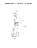 METHOD OF MANUFACTURING A FIBER OPTIC DROP CABLE diagram and image