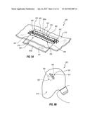 AIRBAG WITH SLIT VENT diagram and image