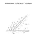 VIBRATION IMPARTING DEVICE FOR A CONCRETE FINISHING TOOL diagram and image