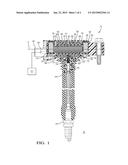 IGNITION COIL diagram and image