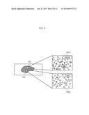 PATHOLOGICAL DIAGNOSIS SUPPORT APPARATUS AND PATHOLOGICAL DIAGNOSIS     SUPPORT METHOD diagram and image