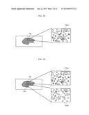 PATHOLOGICAL DIAGNOSIS SUPPORT APPARATUS AND PATHOLOGICAL DIAGNOSIS     SUPPORT METHOD diagram and image