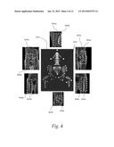 Anatomy Aware Articulated Registration for Image Segmentation diagram and image