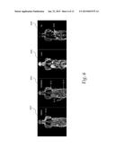 Anatomy Aware Articulated Registration for Image Segmentation diagram and image